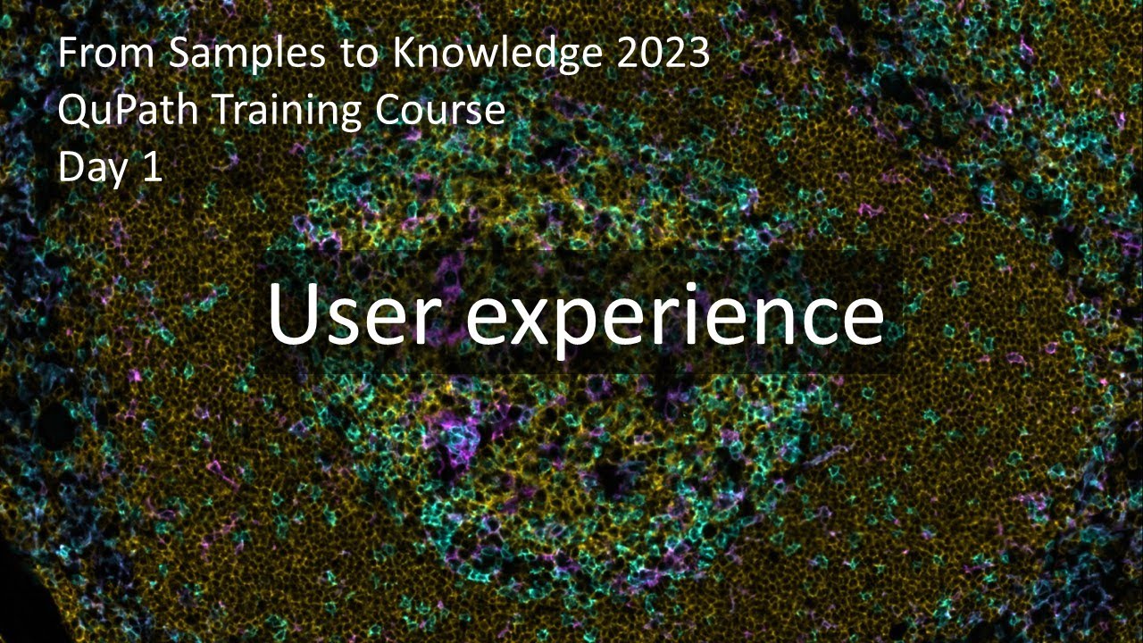 User Experience