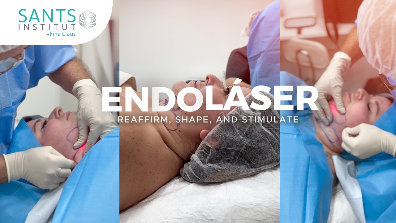 Endolaser / Endolift: How does it work? Does it eliminate sagging skin?