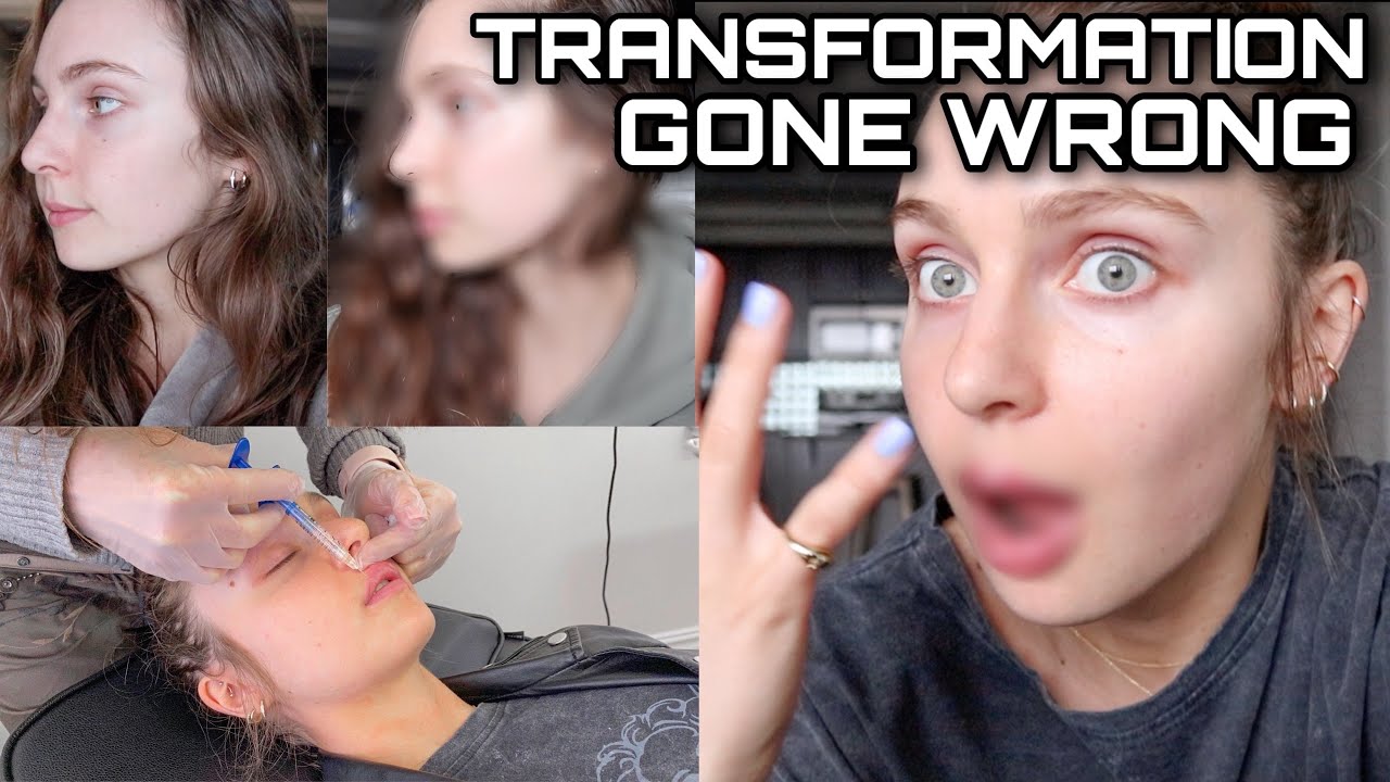INTENSE LIP FILLER EXPERIENCE&hellip; I was not ready for this. attempted no makeup transformation...