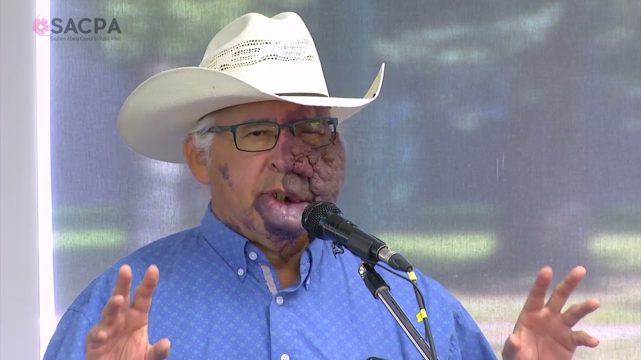 Treaty 7: What are the Impacts from a Blackfoot Perspective? - SACPA - 10/06/2022