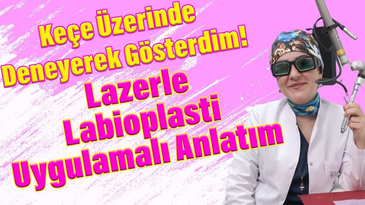 Keçe Üzerinde Deneyerek Gösterdim! Lazerle Labioplasti Uygulamalı Anlatım