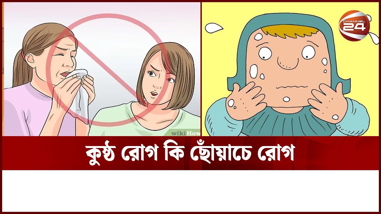 কুষ্ঠ রোগ কি ছোঁয়াচে? | leprosy deases | Channel 24 | Health Tips