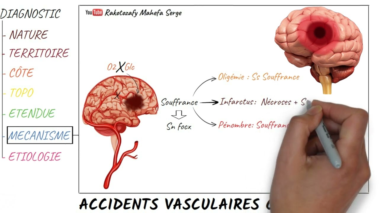 ACCIDENTS VASCULAIRES CEREBRAUX - Première partie : Généralité