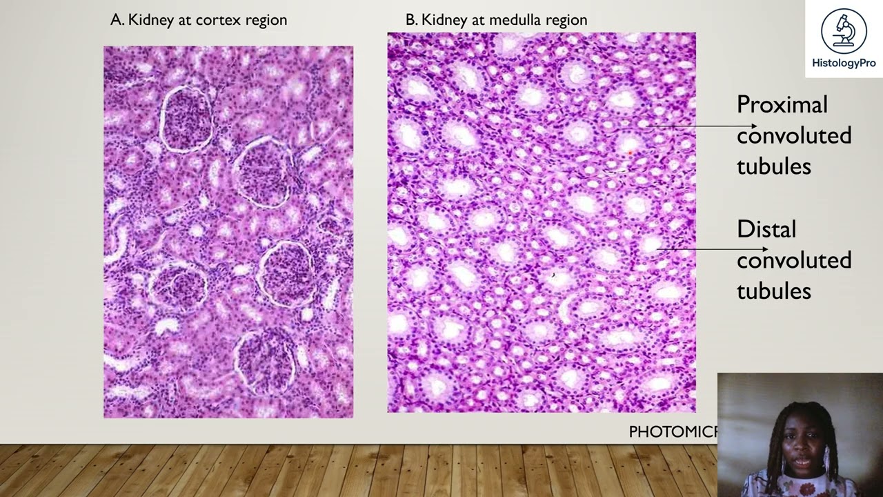 SIMPLE CUBIODAL EPITHELIUM