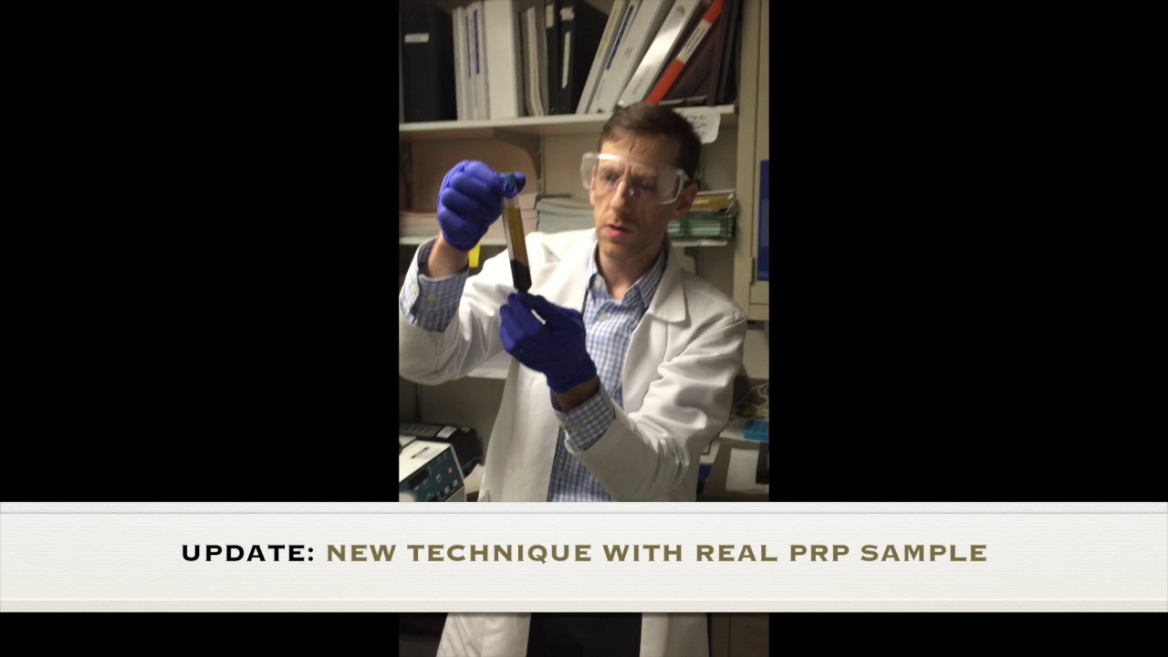 Preparing a PRP Injection 2017 Update