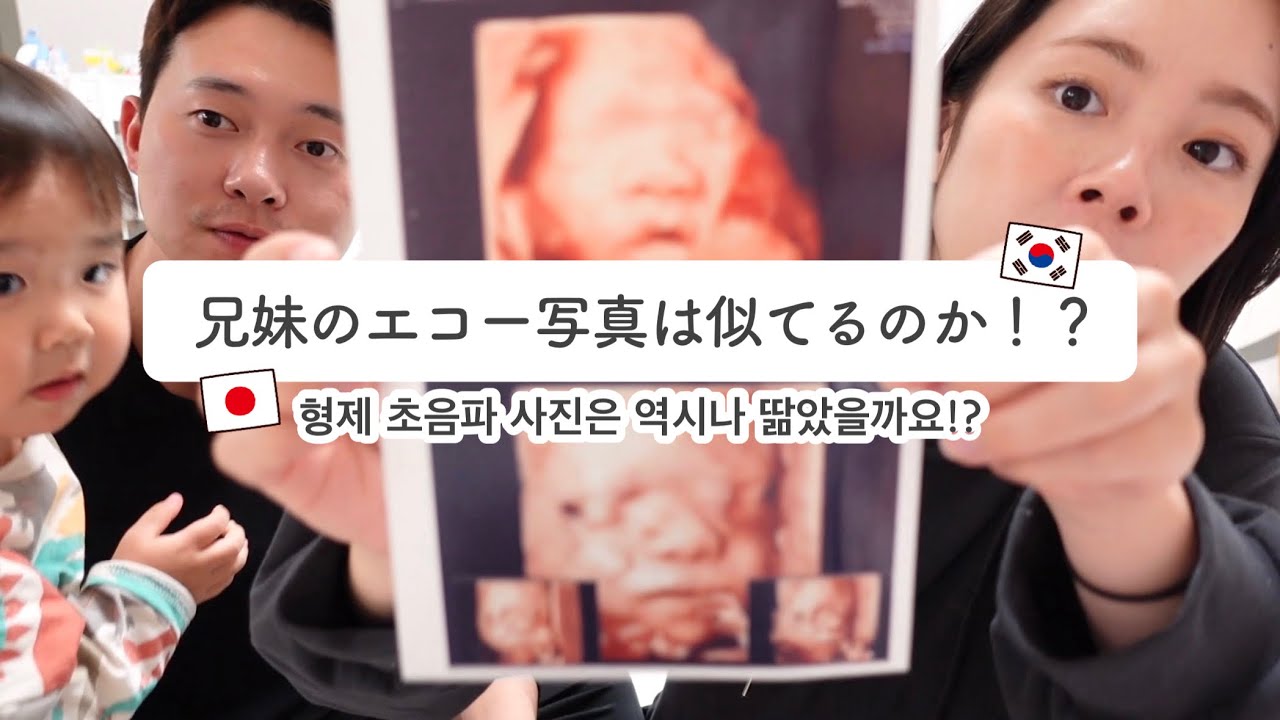２人目ちゃんの4Dエコーを撮ってきました♡ 혼혈아 둘째 얼굴 공개합니다!! [日韓夫婦/한일부부]