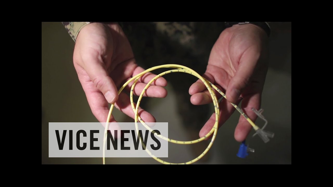 Force-Feeding in Guantanamo: Blacked Out Bay (Part 2)