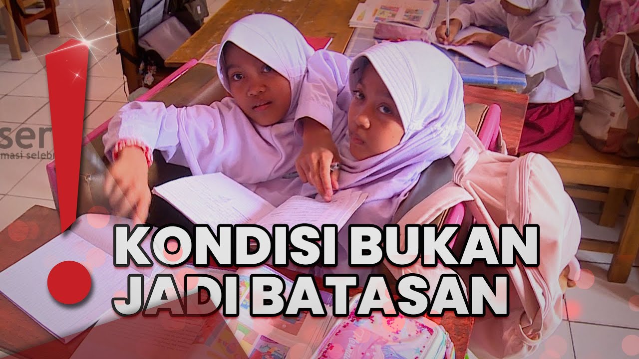 Kembar Dewi-Putri Tetap Aktivitas Seperti Biasa Meski Memiliki Keterbatasan