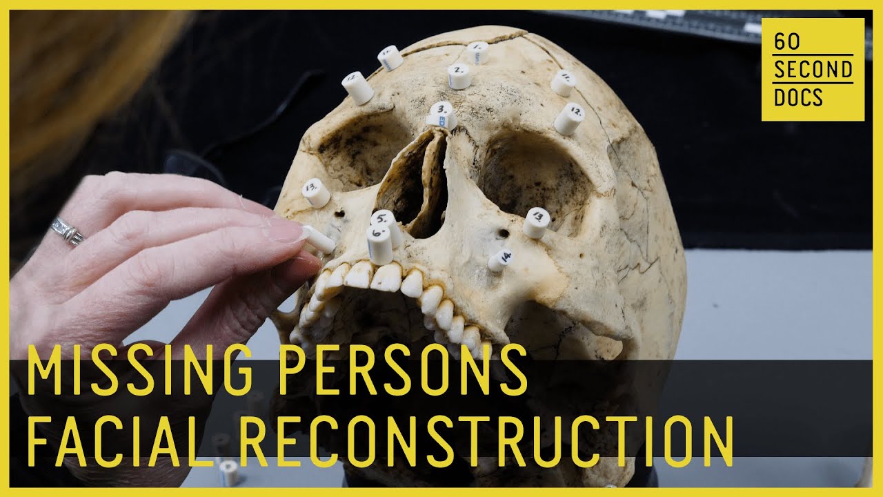 Missing Persons Forensic Facial Reconstruction