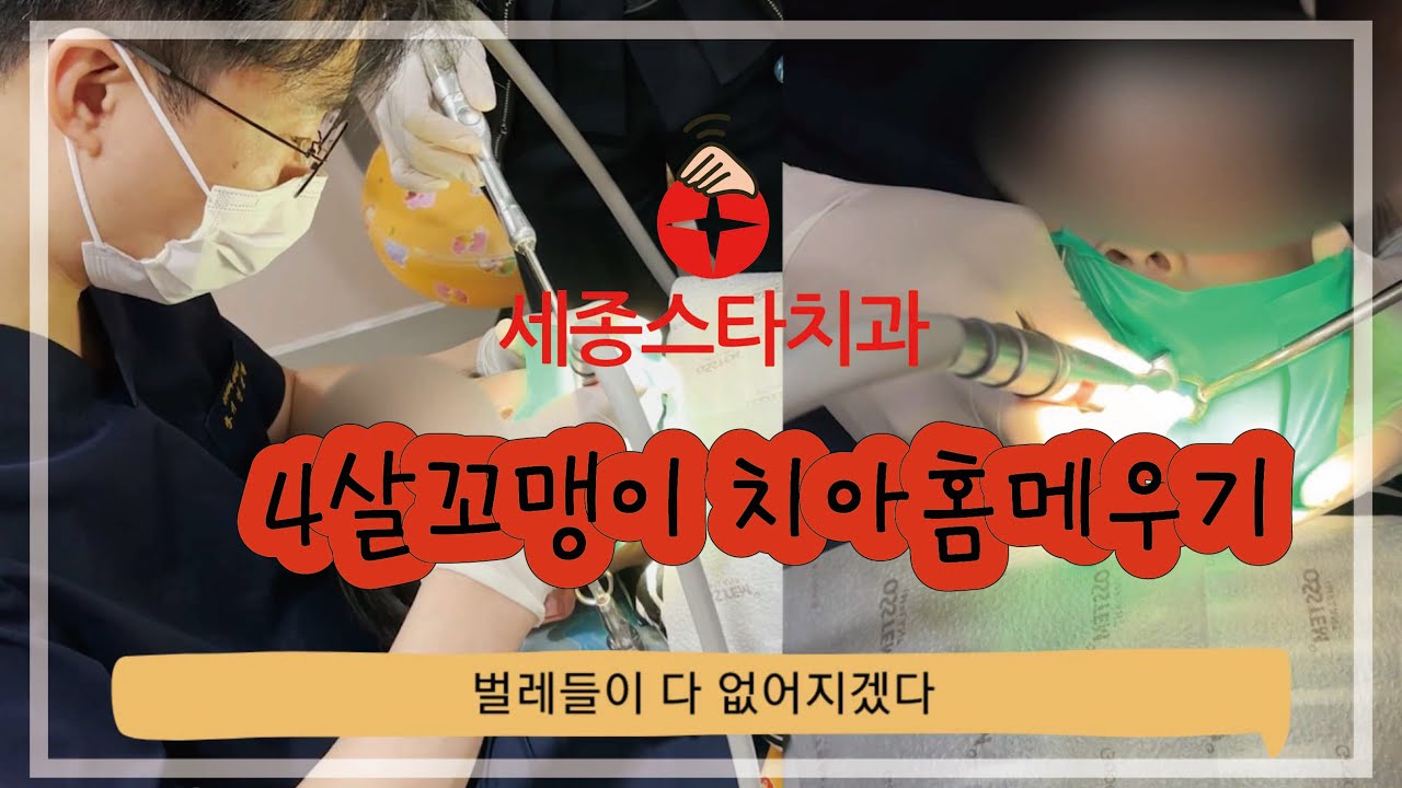 [세종스타치과]4살 치아홈메우기는 어렵지 않아요~