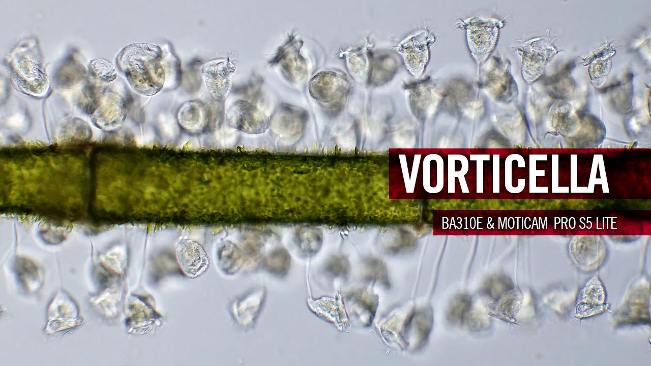 DOCUMENTARIES | Vorticella: The fastest bell in the world? | by Motic Europe