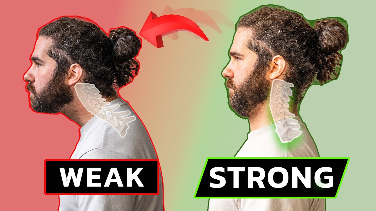 Does A Weak Neck Cause Forward Head Posture?