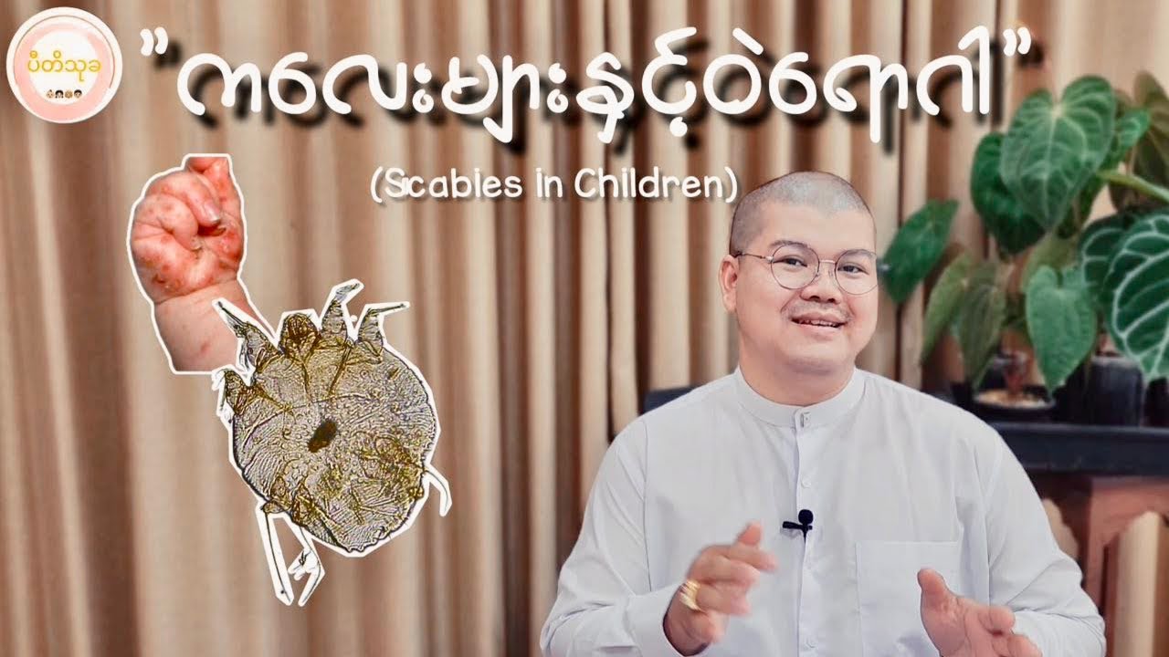 ကလေးများနှင့်ဝဲရောဂါ ( Scabies in Children)