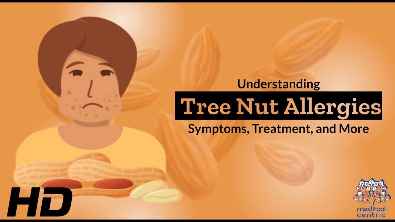 Tree Nut Allergies 101: A Comprehensive Guide to Your Health