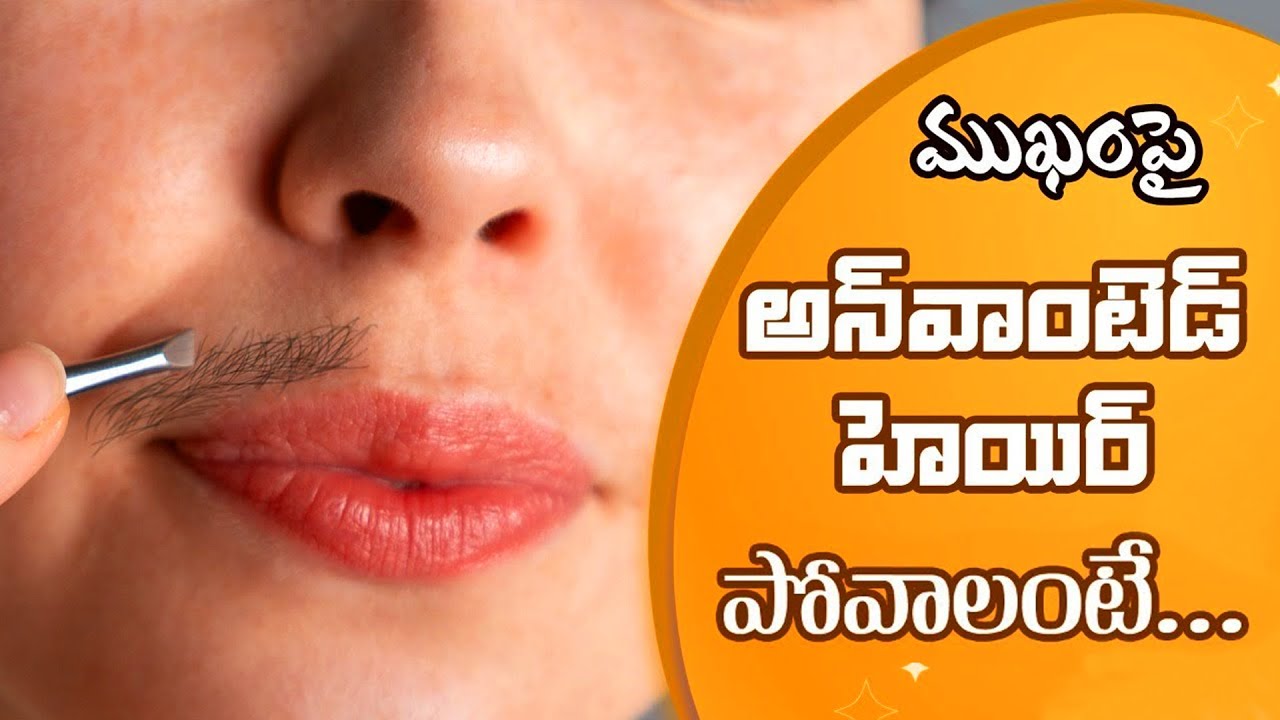 Home Remedy to Remove Unwanted Hair | Diet Plan for Hormone Balance! Beauty Tips!  అవాంఛిత రోమాలు