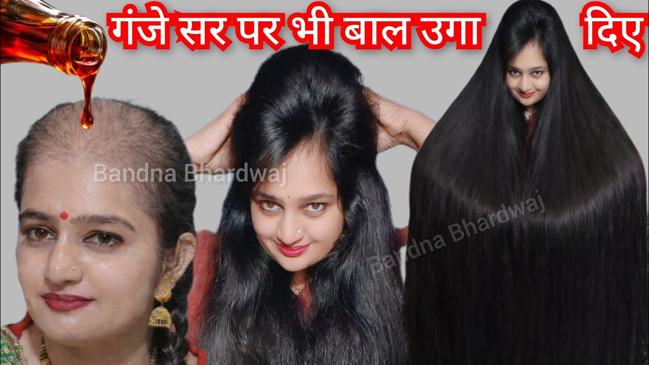 गंजा सर भी बालो से भर जाएगा👉नहाने जाने से 10min पहले लगाना बाल घुटनो तक लंबे हो जाएंगे HairGrowthOil