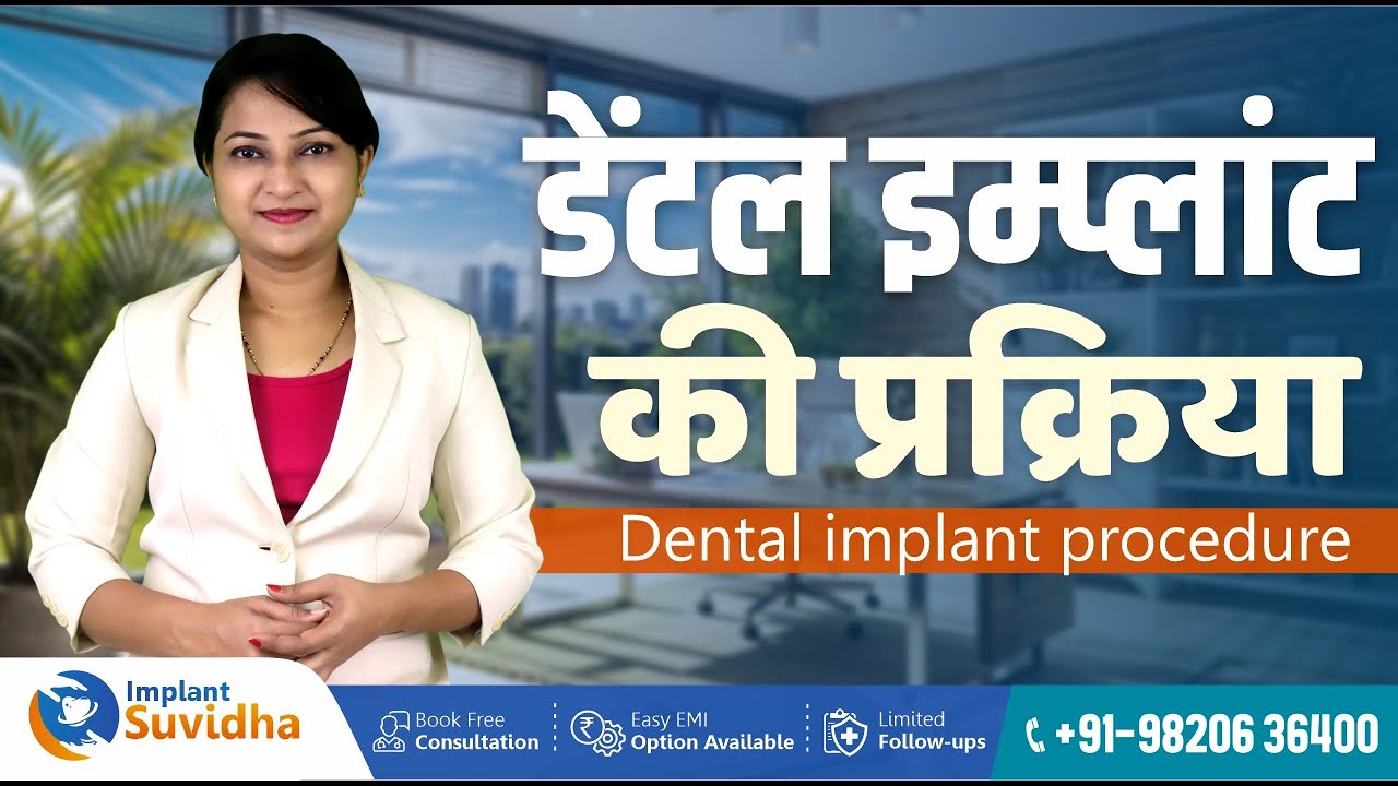 डेंटल इम्प्लांट की प्रक्रिया #dentalimplant #dentalcare