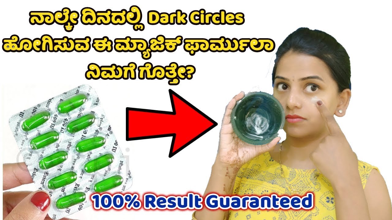 ಡಾರ್ಕ್ ಸರ್ಕಲ್ಸ್ ಗೆ ಸುಲಭ ಪರಿಹಾರ How to remove Dark circles in kannada Shridevi Vlogs Vitamin E capsul