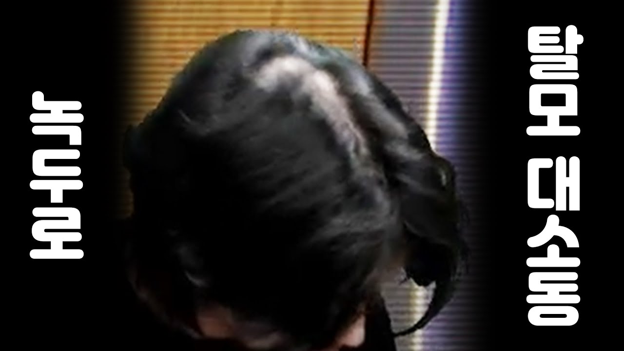 탈모 대소동 [녹두로 하이라이트 편집본 팬영상]