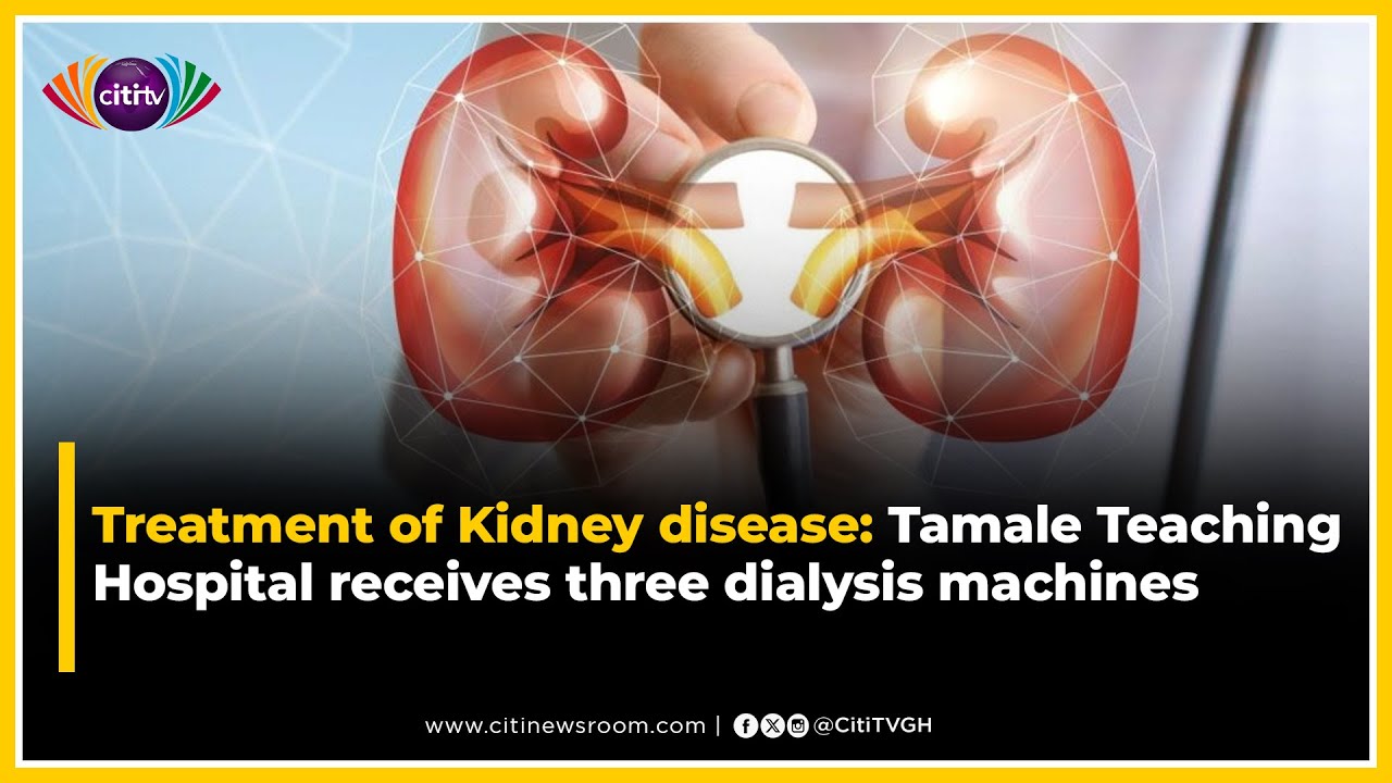 Treatment of Kidney disease: Tamale Teaching Hospital receives three dialysis machines