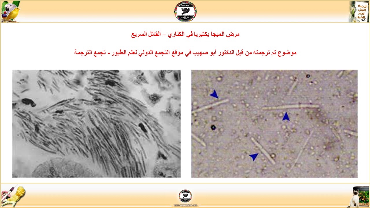 مرض الميجا بكتيريا - MegaBacteria