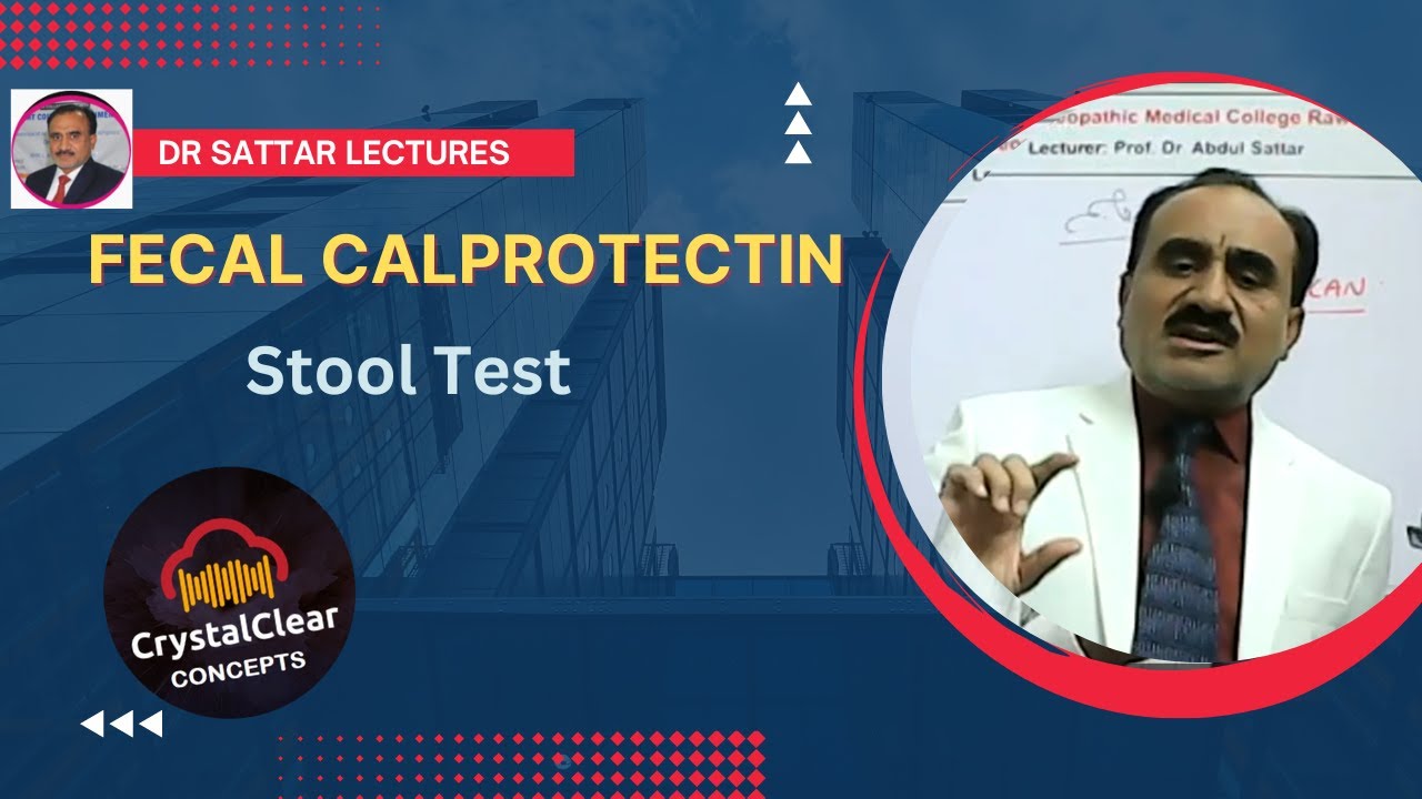 Faecal Calprotectin :    What is the Calprotectin stool test?