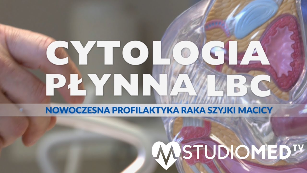 Cytologia płynna LBC - nowoczesna profilaktyka raka szyjki macicy