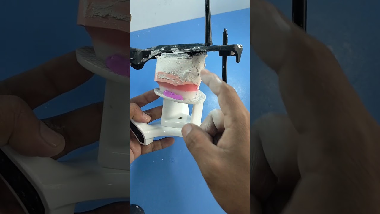 como articular modelos dentales
