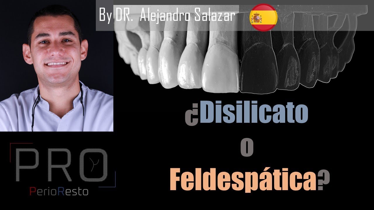 ¿DISILICATO O FELDESPATICA? cual es el MEJOR MATERIAL para nuestras CARILLAS DENTALES?