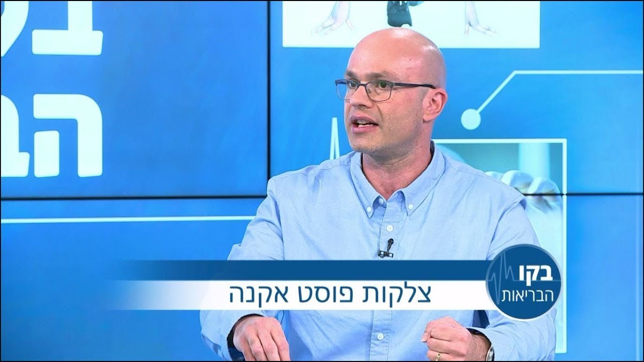טיפול לצלקות פוסט אקנה- ד