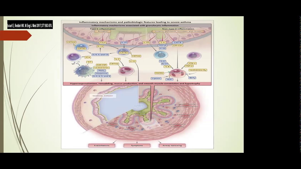 01/26/2021 Alarmins in Asthma: TSLP, IL-33, IL-25