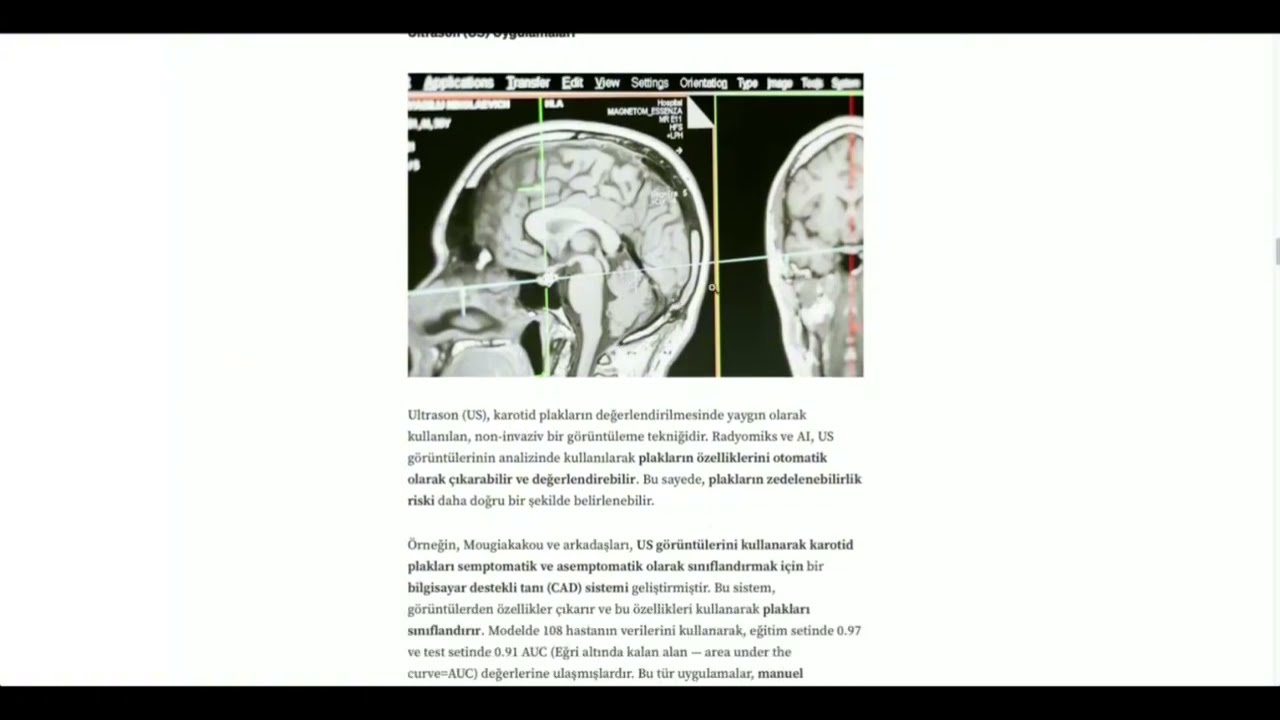 Yapay Zeka ve Radyomiks - (Radiomics and Artificial Intelligence)