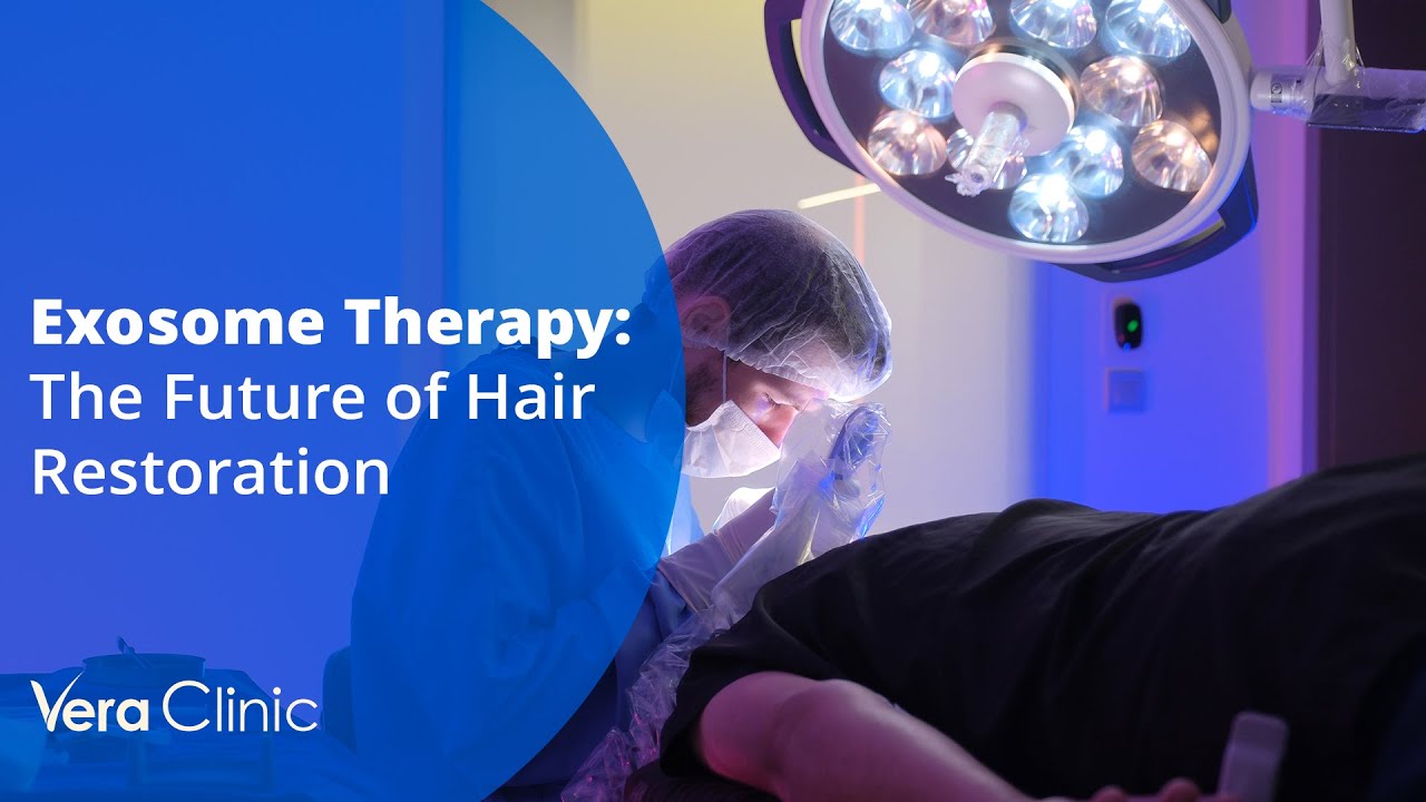 Revolutionizing Hair Restoration I Exosome Therapy