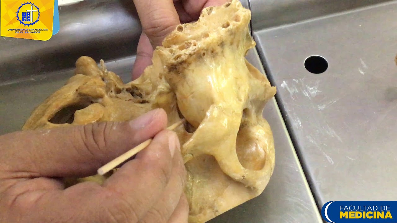 Fosa pterigopalatina  - Dr. Ernesto Hurtado