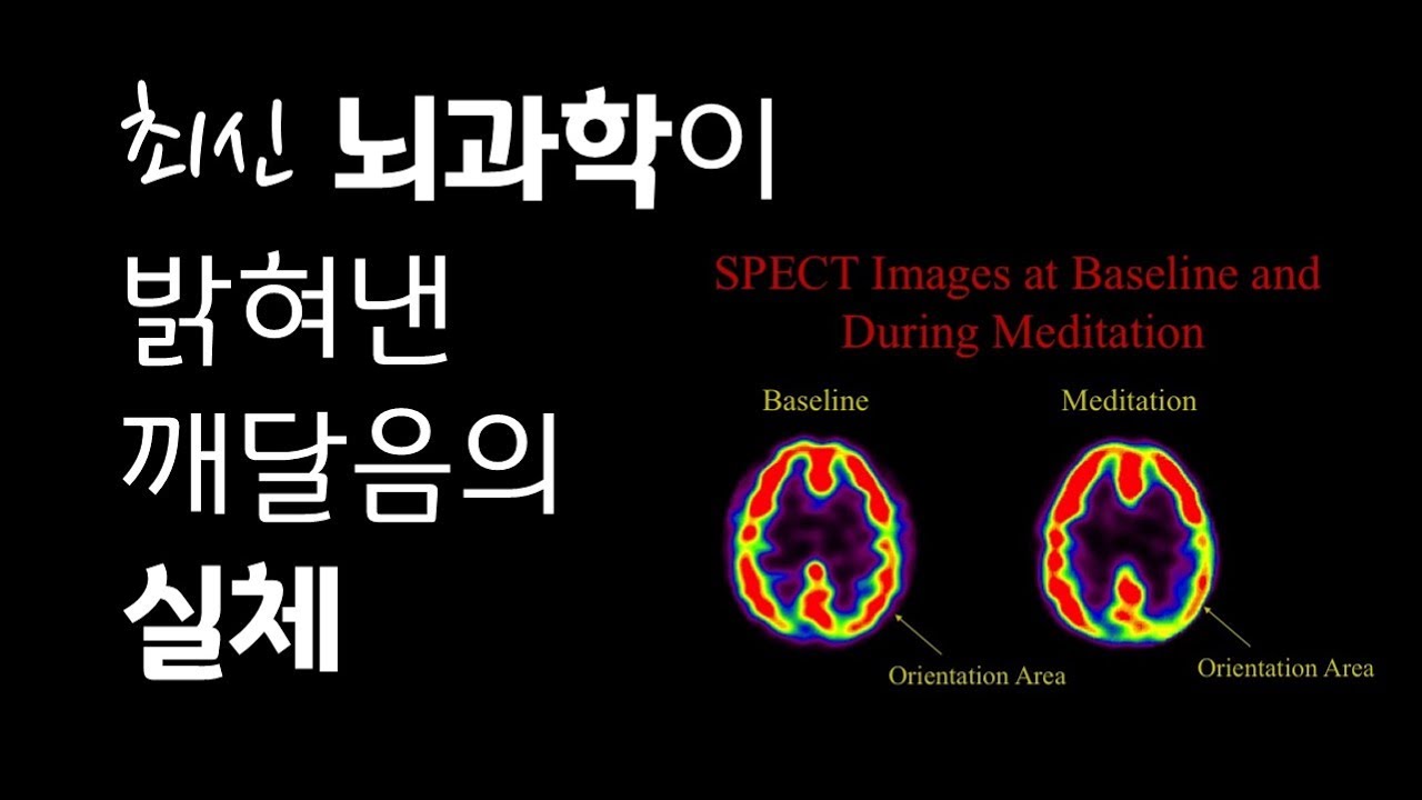 앤드루뉴버그 SPECT실험 (2/4) | 뇌과학이 밝혀낸 깨달음의 실체 | 화이트레빗