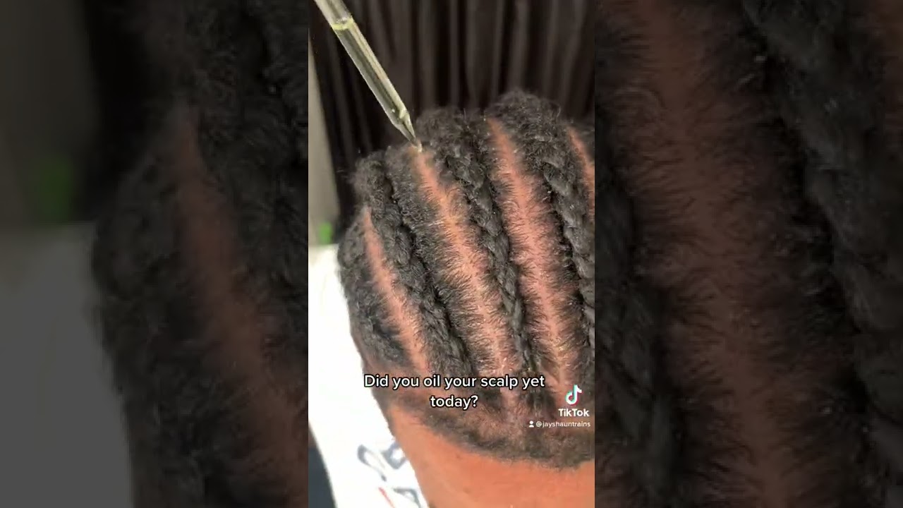 One of the reasons your scalp may be itching!