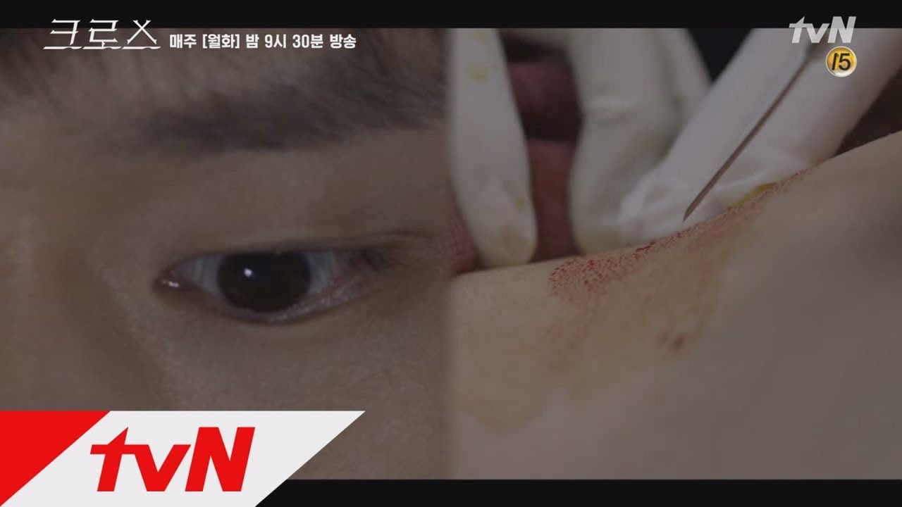 CROSS 고경표, 흔들리는 구급차 안 신들린 응급처치! 180205 EP.3