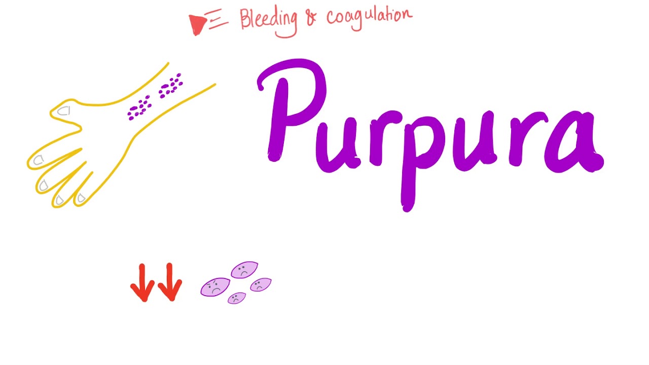 Pupura | Bleeding Disorders