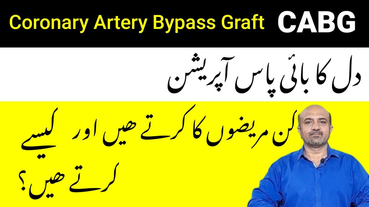 What Is CABG | How Is Coronary Artery Bypass Graft Done | Indications Of CABG