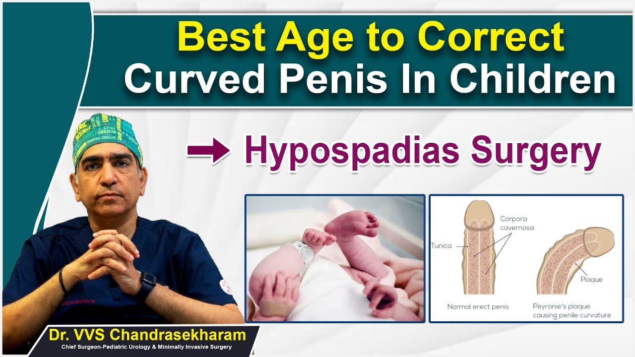 Correct Age for Hypospadias Surgery in Children || Penis Straightening for Kids || Ankura Hospitals