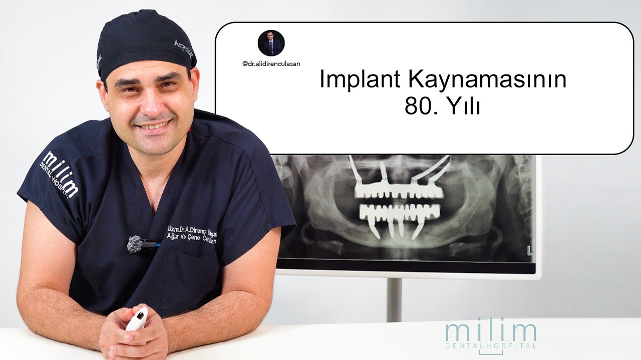 İmplant Kaynamasının 80. Yılı: Br&aring;nemark&rsquo;tan G&uuml;n&uuml;m&uuml;ze Diş İmplantının Evrimi
