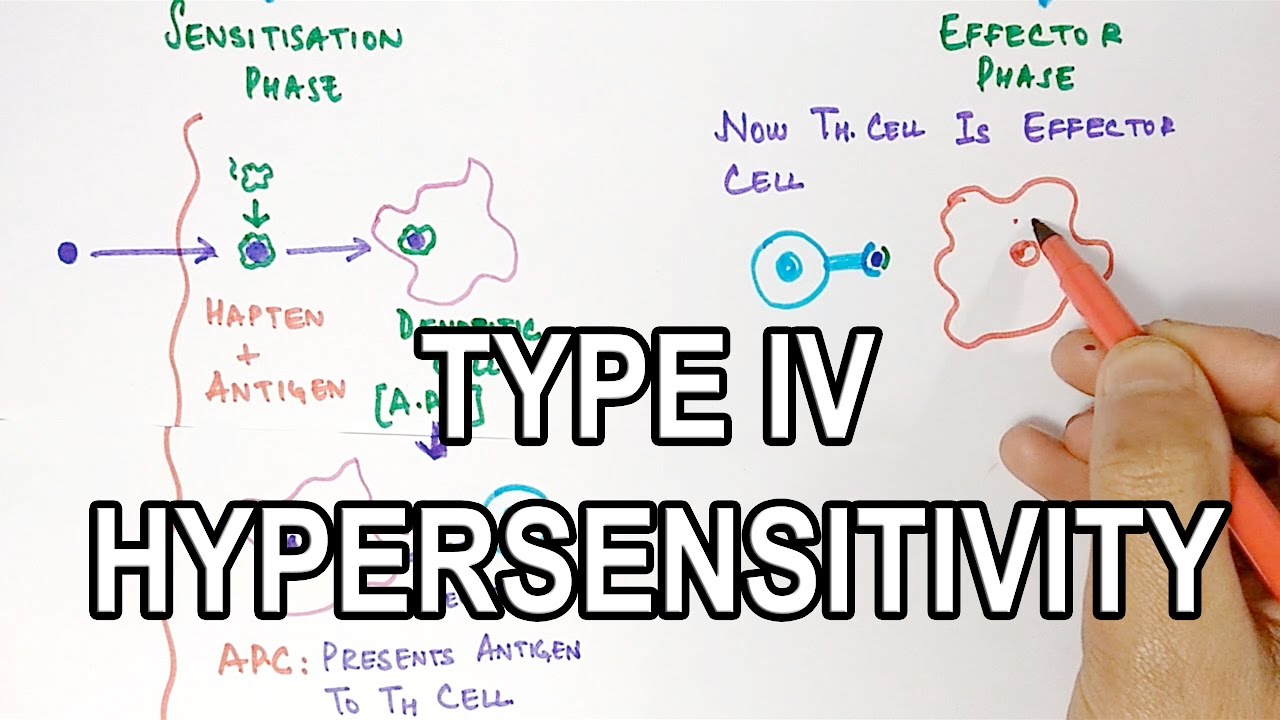 Type IV Hypersensitivity
