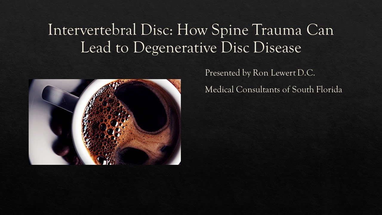 Intervertebral Disc; How spine trauma can lead to degenerative disc disease