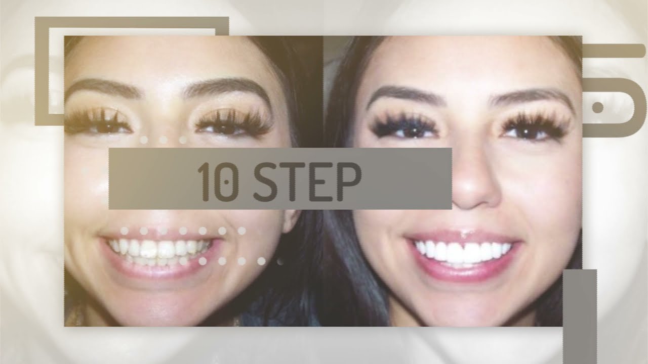 Dr. Zaibak - Transform your smile