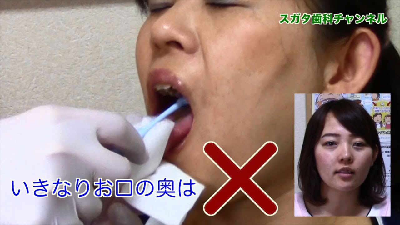 【高松市　歯医者】ワンポイント口腔ケア　舌の清掃編　スガタ歯科チャンネル006（口腔ケアチャンネル）