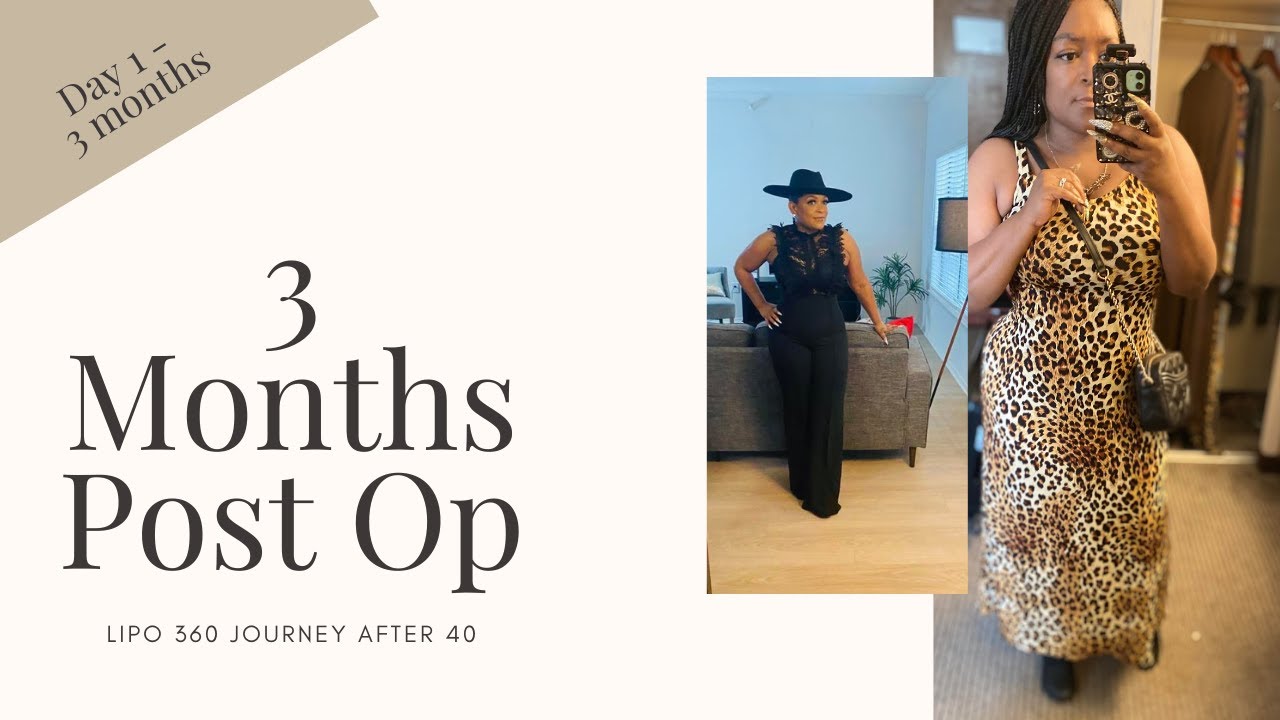 3 Months Post Up | Before & After | Lipo 360 Only