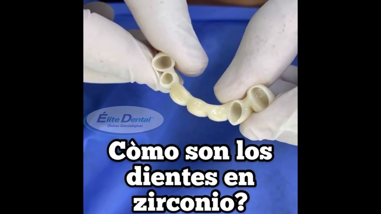 &iexcl;C&oacute;mo son los dientes en Zirconio?