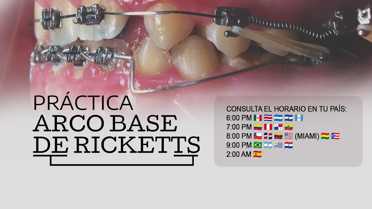 LIVE PRÁCTICA – Arco Base de Ricketts