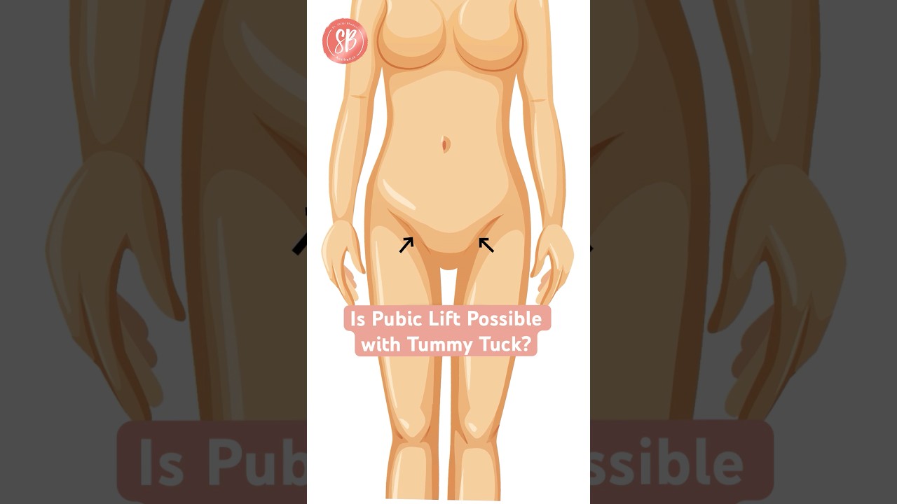Can the pubic area be lifted in a Tummy Tuck? #tummytuck #plasticsurgery #sbaesthetics #shorts