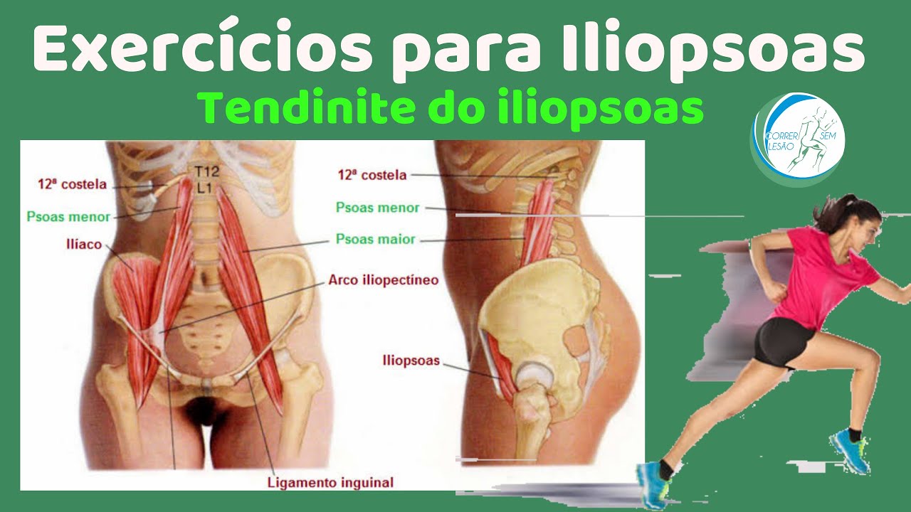 TENDINITE DO ILIOPSOAS | Exercícios que melhoram a corrida, tratamento e prevenção de lesões